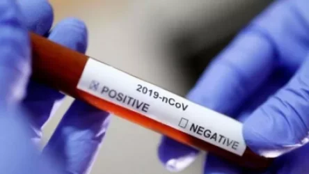 Գեղարքունիքի մարզում հաստատվել է կորոնավիրուսի 31 նոր դեպք, առողջացել է 23 հիվանդ