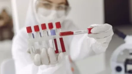 Հայաստանում հաստատվել է կորոնավիրուսով վարակվելու 410, մահվան՝ 17 նոր դեպք