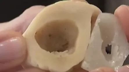 ՏԵՍԱՆՅՈՒԹ. «Ապագան եկել է». Ոսկոր-պրոթեզ, որը միաձուլվում է մարդու  բնական հյուսվածքի հետ