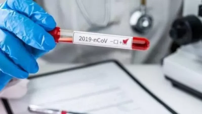 ՀՀ-ում քաղաքացու մոտ կորոնավիրուսի վարակումից 40 օր անց կրկին ախտորոշվել է Covid-19