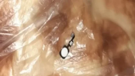 Ռենտգեն սարքի միջոցով բացահայտվել է արգելված իրի ներթափանցումը քրեակատարողական հիմնարկ