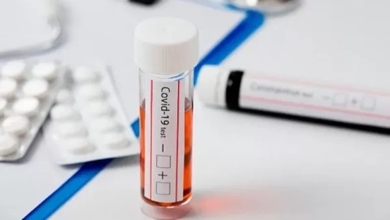 Վրաստանում արձանագրվել է կորոնավիրուսի 10 նոր դեպք