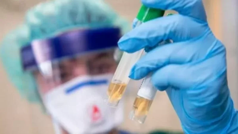 Կորոնավիրուսի վարակման 308 նոր դեպք. ապաքինվել է 467 մարդ