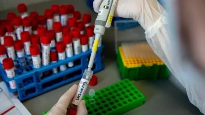 Կորոնավիրուսի դեմ պատվաստանյութը ռուսաստանցիներին հասանելի կլինի օգոստոսի կեսին