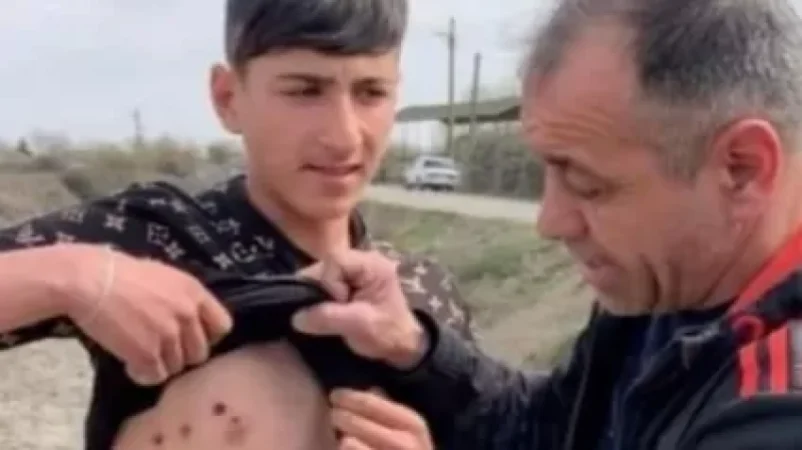 Ադրբեջանում ոստիկանները ցույցի ժամանակ 6 անգամ կրակել են դեռահասի վրա