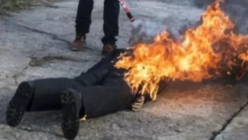 Արտառոց դեպք Նոր Նորքում. մարմնի 90 տոկոս այրվածքներով տղամարդուն տեղափոխել են հիվանդանոց