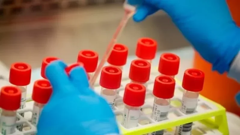 Կորոնավիրուսը հաղթահարած մարդը կարող է առողջանալուց անմիջապես հետո նույնիսկ վարակվել կորոնավիրուսի նոր շտամմով