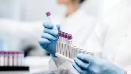 Հայաստանում COVID-19-ի հաստատված դեպքերն՝ այսօր