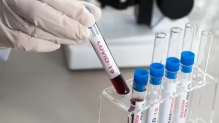 Հայաստանում մեկ օրում կորոնավիրուսի 1587 նոր դեպք է հաստատվել