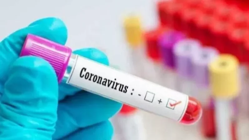 Արցախում կորոնավիրուսային վարակ է հաստատվել 3 քաղաքացու մոտ