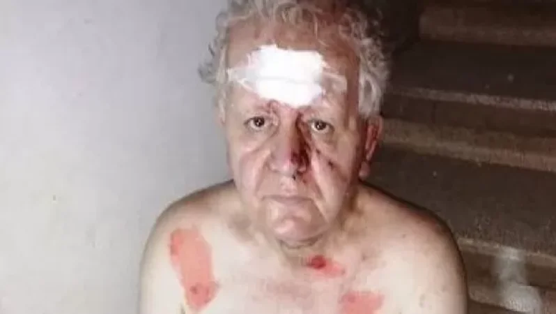 Բեյրութում պայթյունից վիրավորվել է լրագրող Համո Մոսկոֆյանը