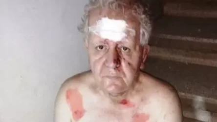 Բեյրութում պայթյունից վիրավորվել է լրագրող Համո Մոսկոֆյանը