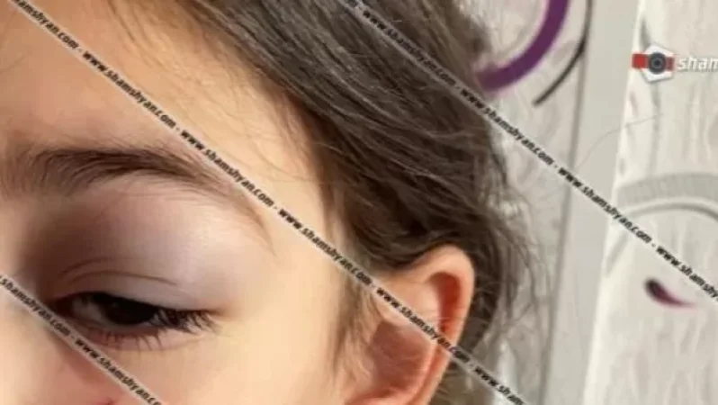 4-ամյա երեխան «Մեգամոլում» մետաղյա ձողով վնասել է աչքը. ծնողը ահազանգում է, իսկ «Մեգամոլը» պարզաբանում