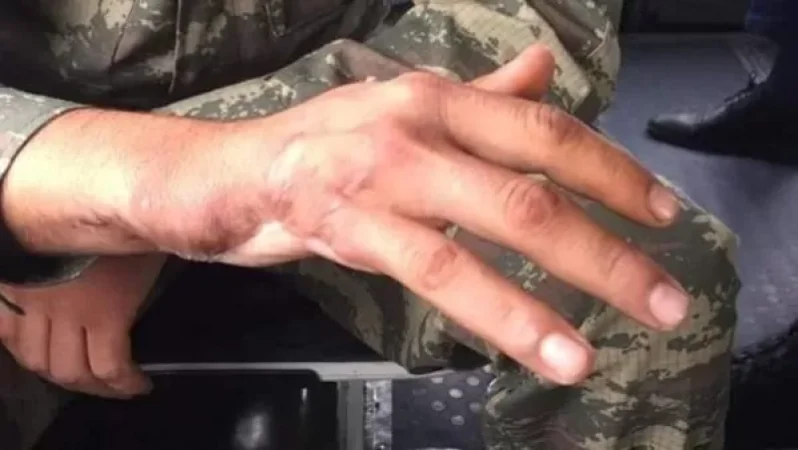 Ադրբեջանում հավաքների են կանչում ֆիզիկական, հոգեկան և մտավոր հաշմանդամություն ունեցող անձանց. Ալեն Ղուլյան