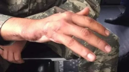 Ադրբեջանում հավաքների են կանչում ֆիզիկական, հոգեկան և մտավոր հաշմանդամություն ունեցող անձանց. Ալեն Ղուլյան