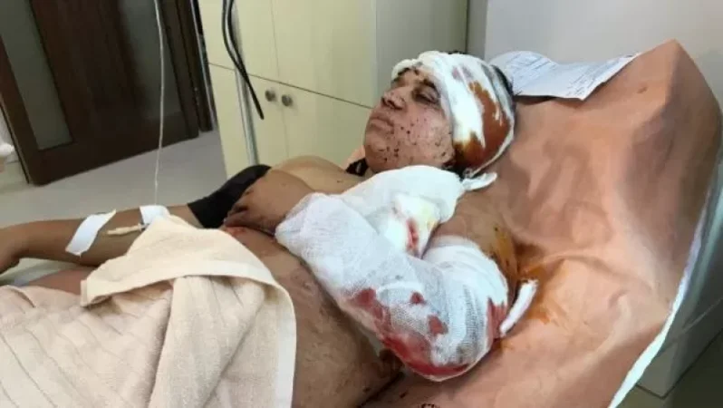 More Than 50 Injured in Artsakh