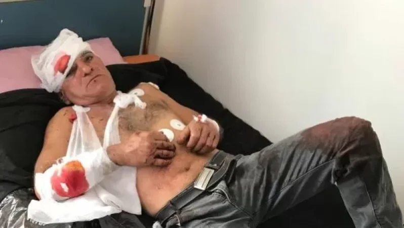 Casualties Reported in Artsakh Amid Civilian Attacks