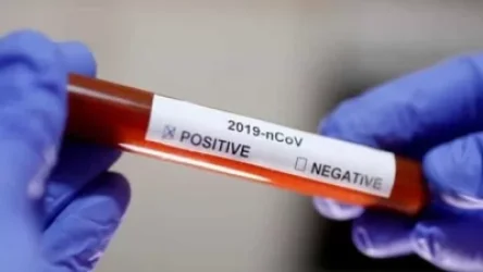 Հայաստանում արձանագրվել է կորոնավիրուսի 672 նոր դեպք. արձանագրվել է 5 մահ