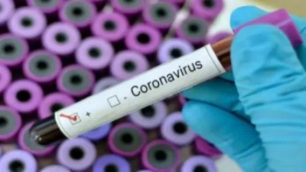 Զորահավաքի ենթակա անձի մոտ COVID-19- ի դրական պատասխանի դեպքում մեծ հավանականությամբ վերստուգում է լինելու