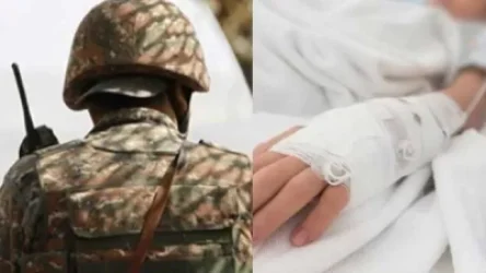 Ի՞նչ է կատարվել, ինչպե՞ս է զինծառայողը այրվածքներ ստացել. մանրամասներ