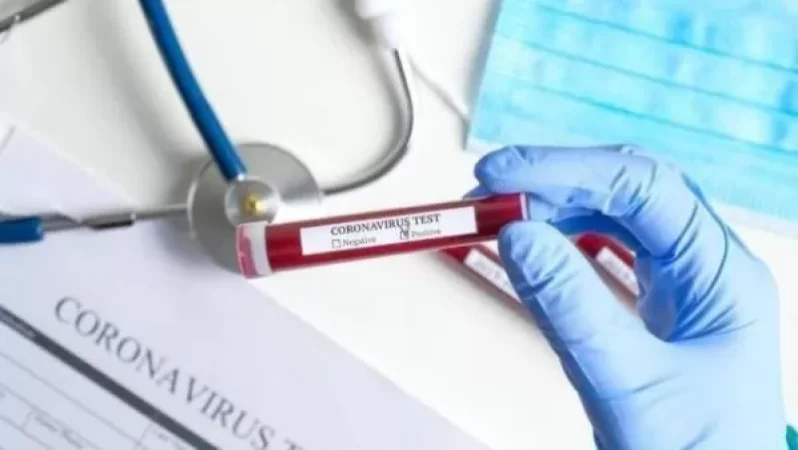 Հայաստանում հաստատվել է կորոնավիրուսով վարակվելու 1267, մահվան՝ 32 նոր դեպք