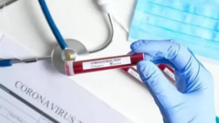 Հայաստանում հաստատվել է կորոնավիրուսով վարակվելու 1267, մահվան՝ 32 նոր դեպք