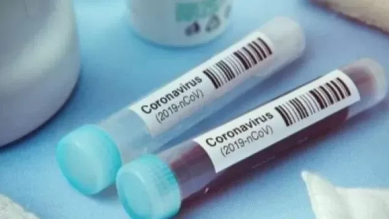 COVID-19 Cases in Armenia Rise by 978 in the Last Day: Ministry of Health
