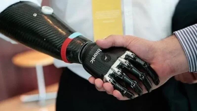 Վիրավոր տղաները կունենան ձեռքերի գերժամանակակից պրոթեզներ