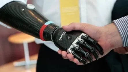 Վիրավոր տղաները կունենան ձեռքերի գերժամանակակից պրոթեզներ