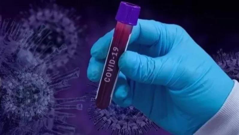 Հայաստանում կորոնավիրուսի 485 նոր դեպք է գրանցվել