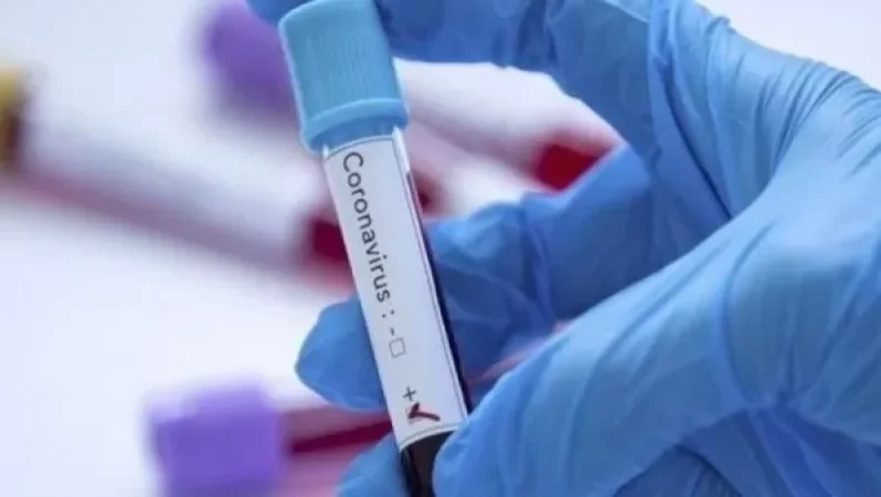 Հայաստանում մեկ օրում հաստատվել է կորոնավիրուսի 355 նոր դեպք