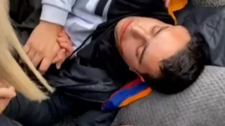 «Ֆրանսիայում հայերի վրա մուրճով հարձակված թուրքը կպատժվի 10 տարի ազատազրկմամբ». Հայկ Գրիգորյան