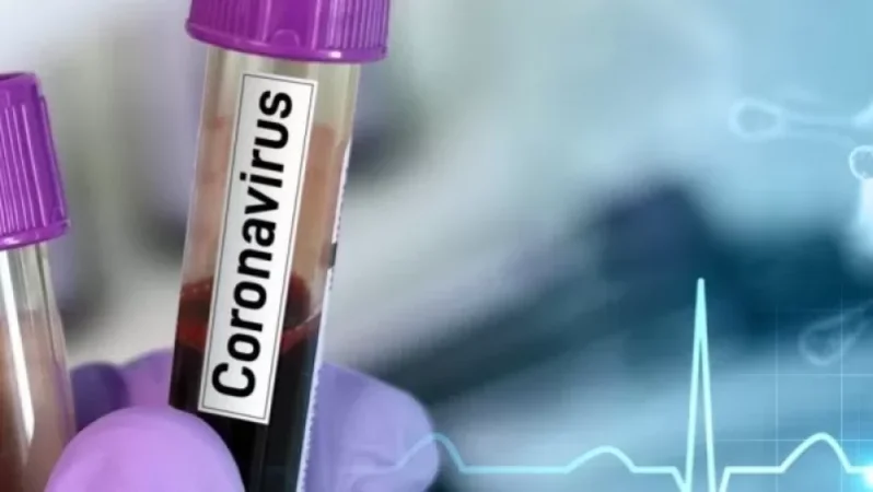 Կորոնավիրուսի տվյալները այսօրվա դրությամբ. Քանի՞  նոր վարակման և մահվան դեպք է հաստատվել