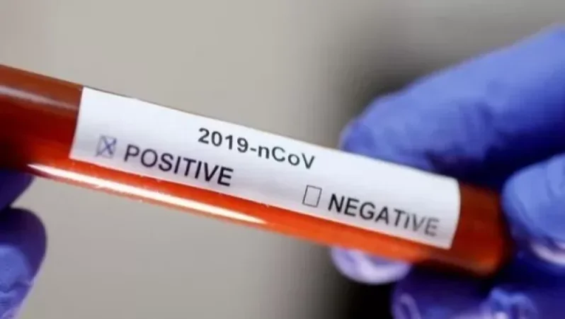 Հայաստանում մեկ օրում հաստատվել է կորոնավիրուսի 777 դեպք