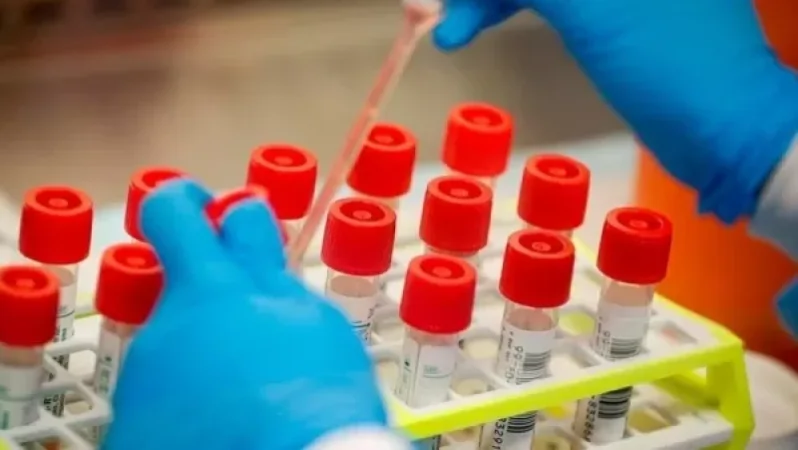 Կորոնավիրուսային հիվանդության այսօրվա տվյալները