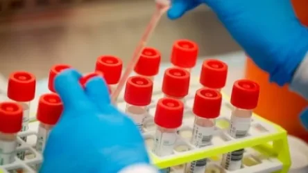 Կորոնավիրուսային հիվանդության այսօրվա տվյալները