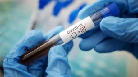 Հայաստանում այսօր հաստատվել է կորոնավիրուսով վարակվելու 547 նոր դեպք