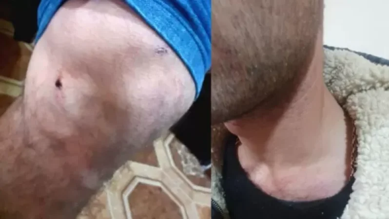 ՀՐԱՏԱՊ․ Արցախում ադրբեջանցիները բռնություն են գործադրել հայ երիտասարդների նկատմամբ