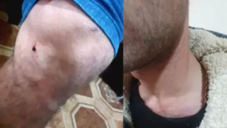 ՀՐԱՏԱՊ․ Արցախում ադրբեջանցիները բռնություն են գործադրել հայ երիտասարդների նկատմամբ