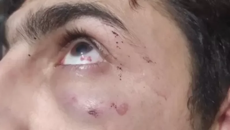 Խոշտանգման դեպք ոստիկանական բաժանմունքում․ Փաստաբանը լուսանկարներ է հրապարակել