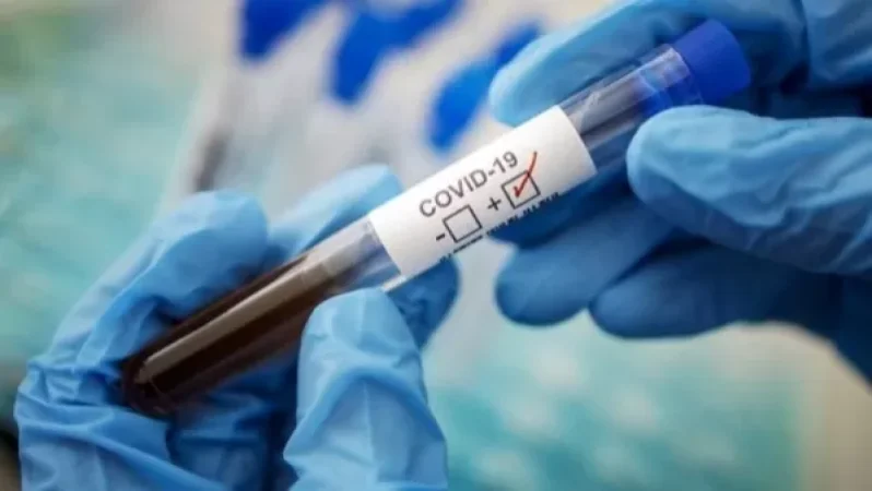 Կորոնավիրուսային հիվանդության ընթացքը Հայաստանում . ԱՆ հրապարակել է նոր տվյալները