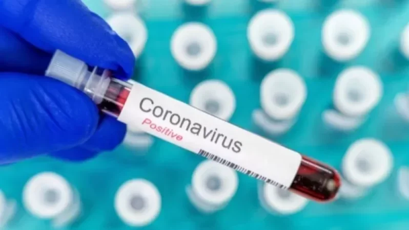 Կորոնավիրուսային հիվանդության ընթացքը Հայաստանում. ԱՆ հրապարակել է այսօրվա տվյալները