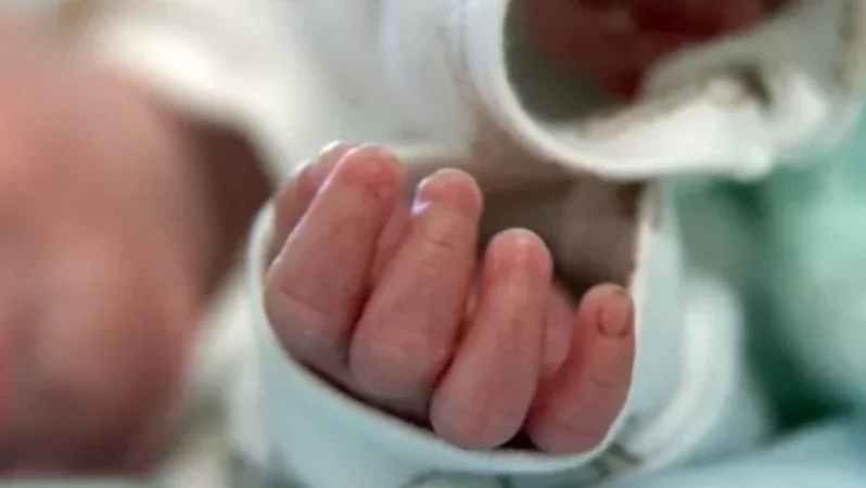 Photo: What Does a Three-Headed Child Born in India Look Like?