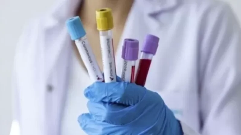 Կորոնավիրուսի գրանցված նոր դեպքերն այսօր․ թիվն աճում է, ունենք 7 մահ