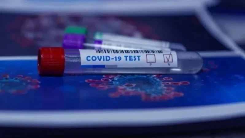 Կորոնավիրուսային հիվանդության ընթացքը Հայաստանում