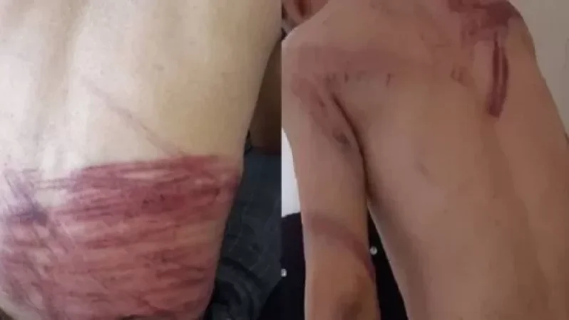 Թալիբները հարձակվել են լրագրողների վրա և մտրակներով ծեծի ենթարկել