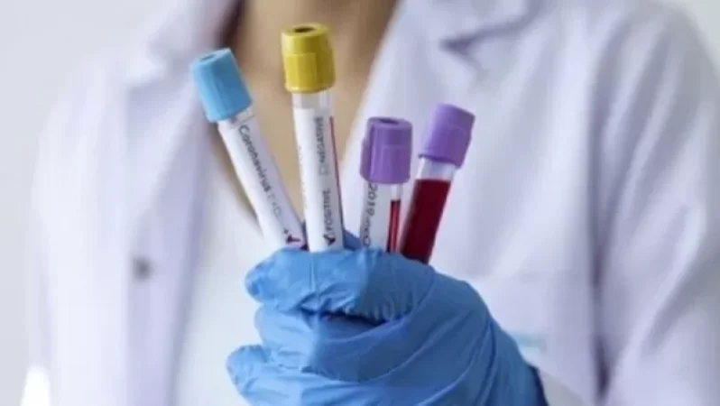 Որքա՞ն են կազմում թեստերի ինքնարժեքը. hraparak