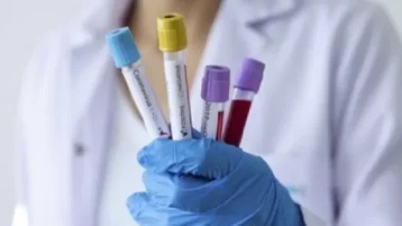 Որքա՞ն են կազմում թեստերի ինքնարժեքը. hraparak