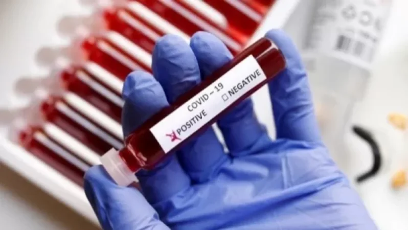 Պատվաստման կամ ՊՌՇ թեստի սերտիֆիկատը կկցվի աշխատողի անձնական գործին