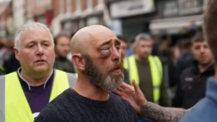 ՏԵՍԱՆՅՈՒԹ. Ծեծկռտուք, թե՞ խաղ, որին մասնակցելուց հետո նման կապտուկներ կունենաք